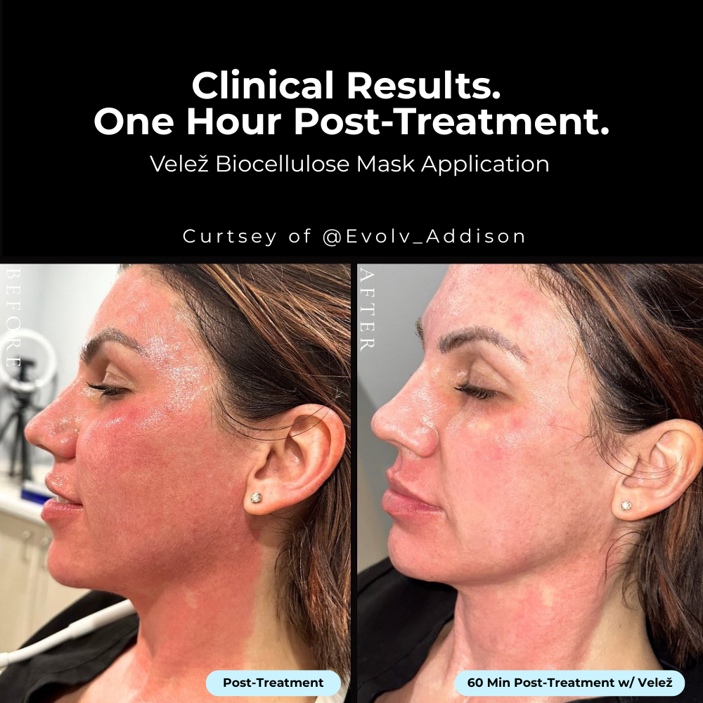 Intense Hydration Face Mask (Backbar - 25 Masks)